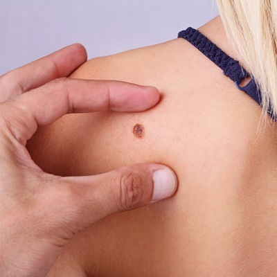 <span style="font-weight: bold;">Удаление образований<br></span>